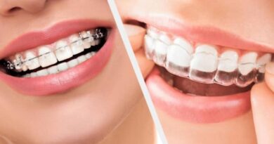 orthodontiste paris adulte