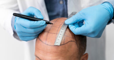 Calvitie : quel médecin spécialiste consulter pour vos cheveux ?