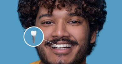 Implants dentaires à Lyon : innovations, techniques et nouvelles tendances