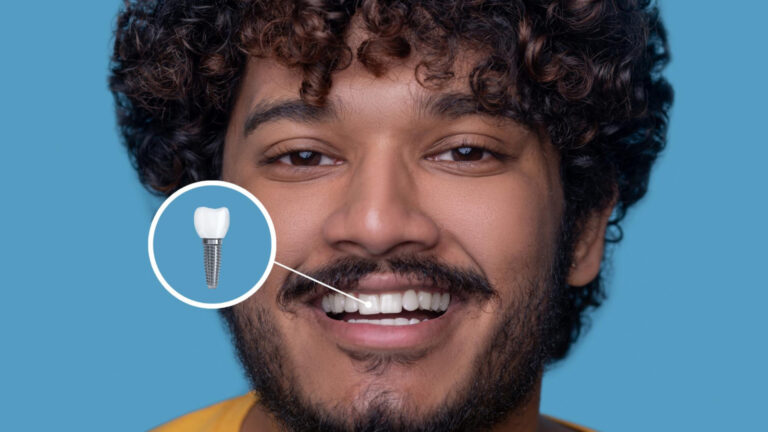 Implants dentaires à Lyon : innovations, techniques et nouvelles tendances