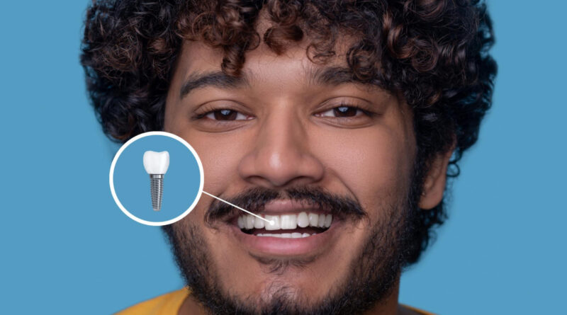 Implants dentaires à Lyon : innovations, techniques et nouvelles tendances